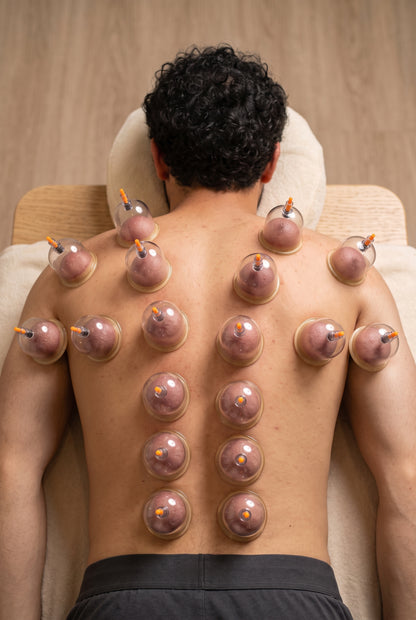 Man's back with clear hijama cups applied during a cupping session
